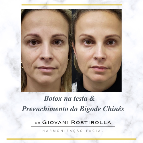 Bigode chines e harmoniz