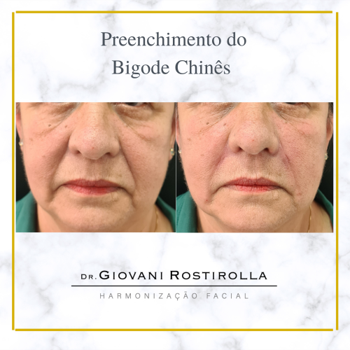 Cópia de Cópia de Cópia de Preenchimento do Bigode Chinês (1)