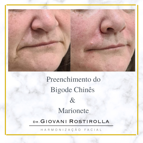 Cópia de Preenchimento do Bigode Chinês (1)
